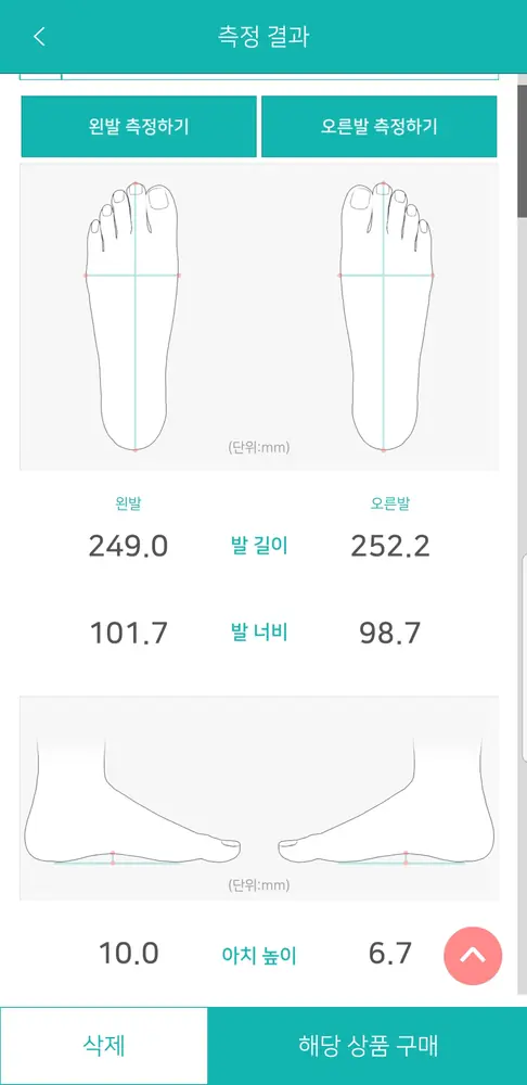 XShoe — 3D 발 계측 시스템 — 측정 결과 — 발 길이 · 너비 · 아치 높이